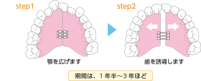床矯正